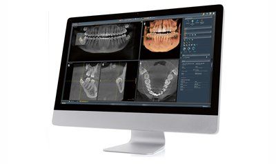 dental software